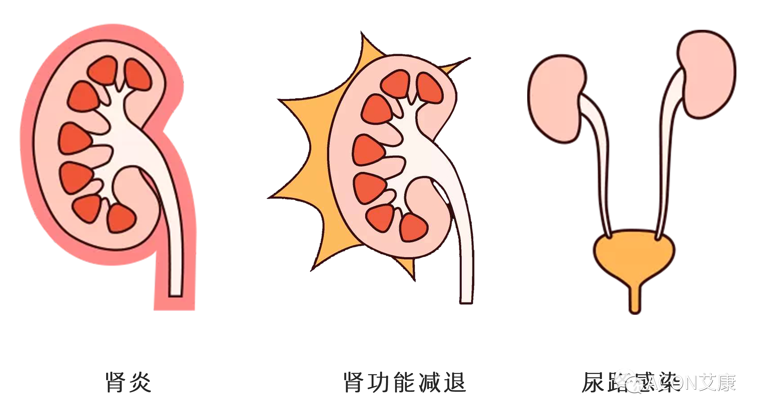 排尿黄、异味大，可能是身体在报警！