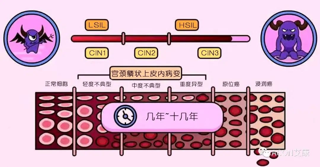 全球首次承诺消除一种癌症，预计到2050年将挽救500万人的生命